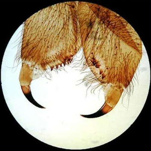 AmScope 25pc Prepared Glass Microscope Slides in Plastic Case with Plant, Fungus, Insect and Mammal Specimens